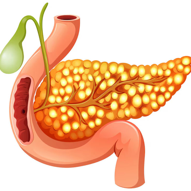 Gallbladder Treatment